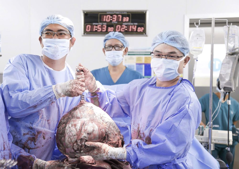 Bệnh viện Từ Dũ phẫu thuật thành công khối u nặng 12kg